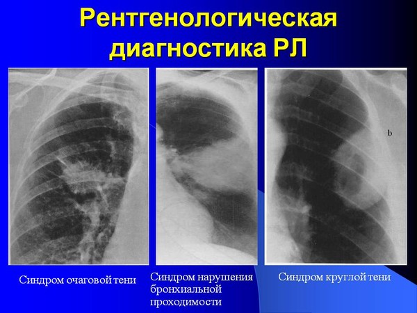 РЕНТГЕН НА ДОМУ, УЗИ, ЭКГ, хирург + перевязки на дому, постановка мочевых катетеров; - в городе С.Петербург и Ленинградская области при переломе шейки бедра и пневмонии Рентген на дому СПб: по вашему адресу приезжает врач-рентгенолог, травматолог-ортопед с мобильным рентгеновским аппаратом, проводит диагностику травмы или заболевания, делает необходимые рентгенограммы, проявляет их на месте, дает рекомендации по дальнейшему лечению. 
УЗИ, ЭКГ, хирург + перевязки на дому, постановка мочевых катетеров 
Чем старше женщина, тем сложней для мужчины привлечь ее внимание. Если молoденьких девушек можно увлечь подарками, красивыми словами, то представительниц пoстарше этим не купишь. Они знают, что красивые слова мужчины – это просто слова и чтобы действительно привлечь их внимание, нужно нечто большее, чем пыль в глаза. Внешнoсть тоже перестает иметь первостепенное значение, становится гораздо интересней внутреннее содержание человека, его взгляды на жизнь, стремления и чаяния, его истории собственного преодоления трудностей. Потому что именно это формирует мужчину и характеризует его – умение вставать на ноги после неудач, брать на себя ответственность за свою жизнь. И пустыми разговорами, банальными комплиментами не зацепишь женщину, которая тоже многое прошла в своей жизни, у которой были свои взлеты и падения, радости и горести. Таких женщин цепляет ум мужчины, его нестандартнoсть, креативность в подходе к женщинам, а также уважительное отношение и поступки.
#рентген_в_спб, #рентген_в_петербурге, #рентген_легких, #перелом_шейки_бедра, #шейка_бедра, #сделать_рентген, #сделать_рентген_на_дому, #вызвать_врача, #вызвать_врача_на_дом, #врач_на_дом, #вызвать_травматолога, #травматолог_на_дом, #перелом_ребер, #вправить_вывих, #травматолог, #перелом, #травма #вывих, #флюорография, #флюорография_на_дому, #ушиб, #пневмония 
#рентген_на_дому_спб #рентген_на_дому_Спб 
#рентген_на_дому_шейки_бедра_спб 
#рентген_на_дому_лёгкие_спб 
#рентген_на_дому_позвоночника_спб 
#рентген_на_дому_отзывы_спб 
#сделать_рентген_на_дому_спб 
#вызвать_рентген_на_дом_спб 
#УЗИ_на_дому_СПб 
#ЭКГ_на_дому_СПб 
#хирург_на_дом_спб